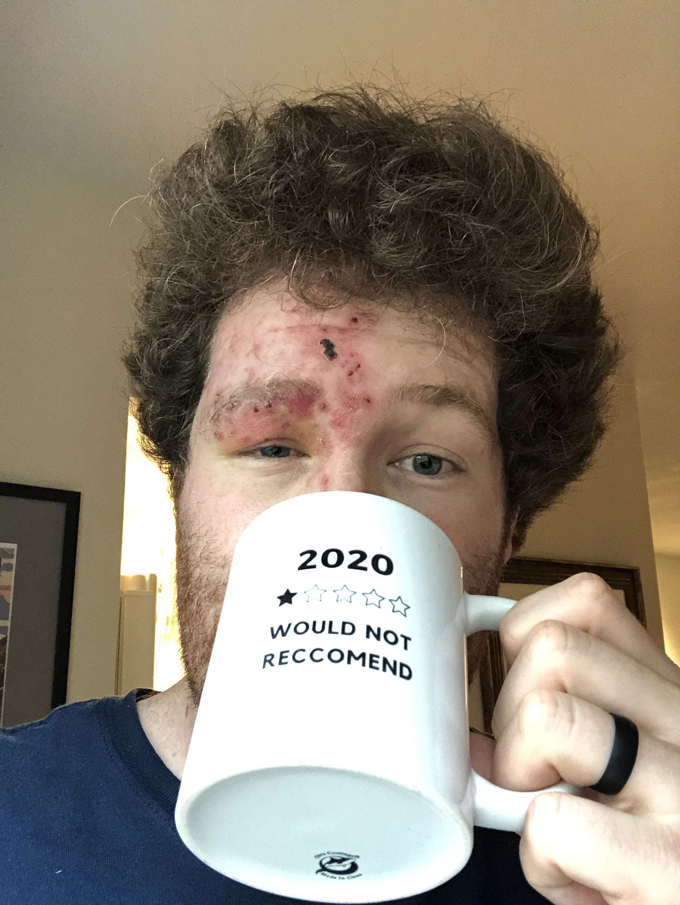 image showing I see your shirt and raise you a cup. Got Covid, unemployed, Somehow got shingles.