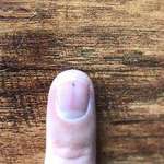 image for The thorn that’s been traveling through my fingernail since July 18 completed its journey today.
