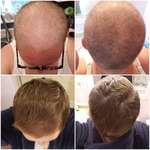 image for 3 months of hair growth after chemo!