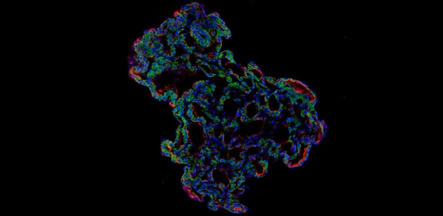 image for ‘Mini-lungs’ reveal early stages of SARS-CoV-2 infection