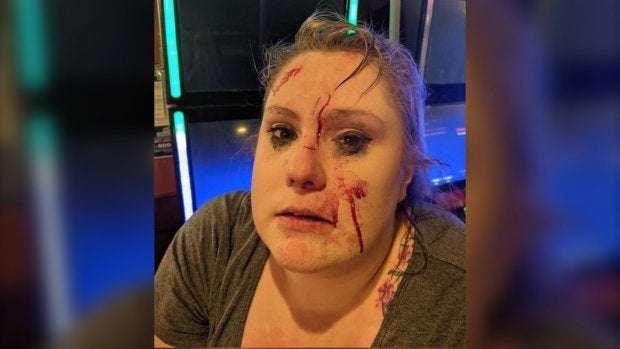 image for Server takes glass to the face after Edmonton pub customer reminded of mask bylaw