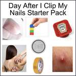 image for Day after I clip my nails starter pack