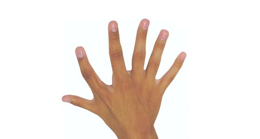 image for A sixth finger can prove extra handy