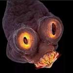 image for The face of a tapeworm under an electron microscope