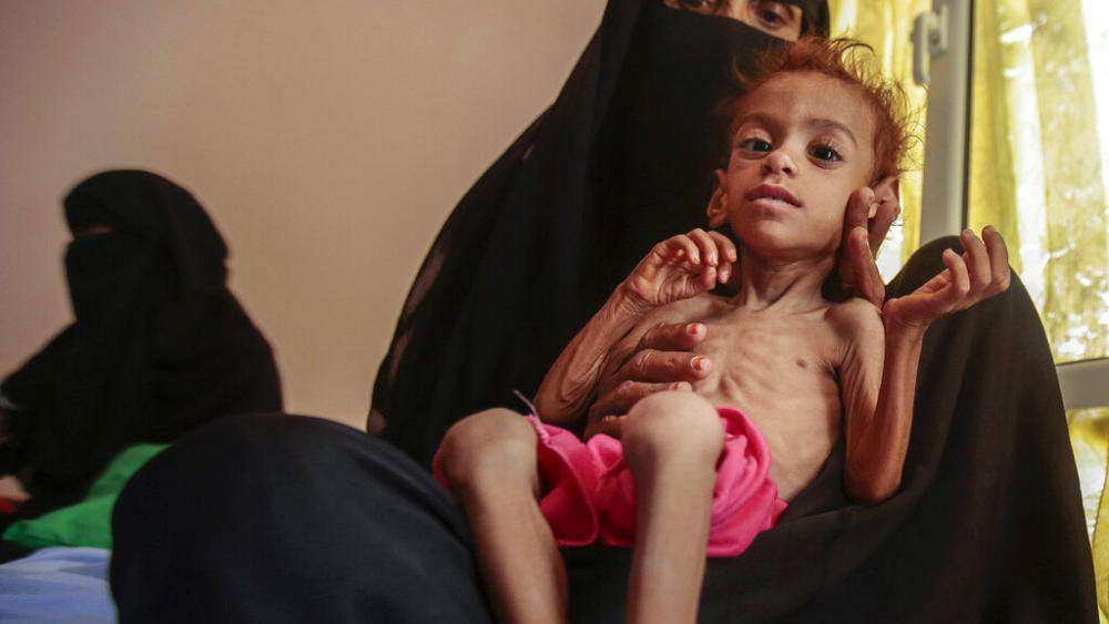 image for Yemen faces a famine as deadly as Ethiopia's during the 1980s, says refugee council head