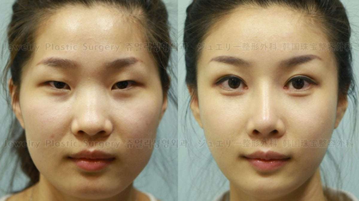 image for How South Korean Plastic Surgeons Make Passport Photos Worthless