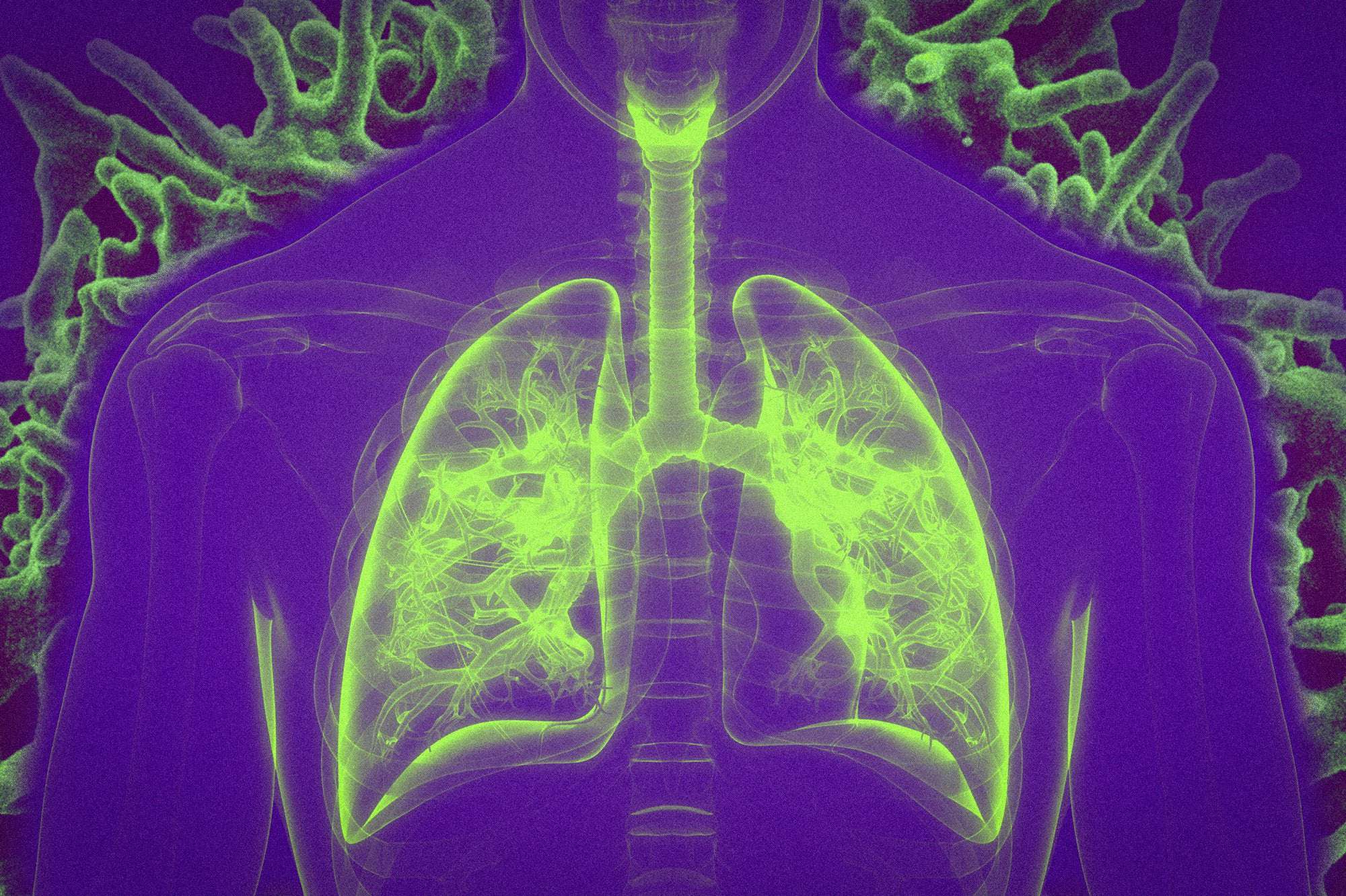 image for Vaccination by inhalation: MIT researchers delivered vaccines directly to the lungs boosting immune responses to viral infections or lung cancer. Vaccinated mice were able to eliminate metastatic melanoma, and the vaccine helped to shrink existing lung tumors. (Science Immunology, 19 Mar 2021)