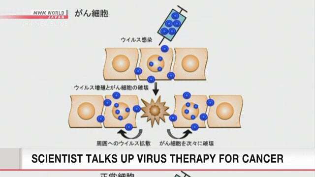 image for Researcher hopeful for his virus cancer therapy