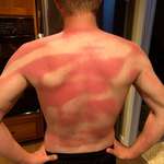 image for My Wife helped me sunscreen my back at beach day today (TWICE)!!