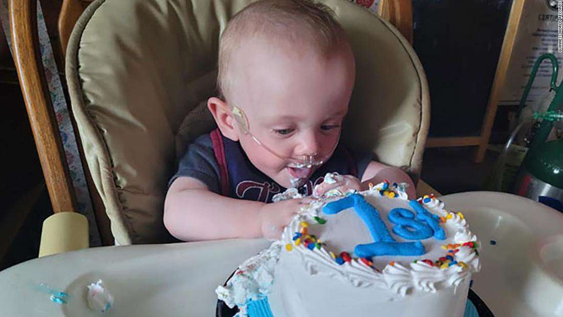 image for The world's most premature baby has celebrated his first birthday after beating 0% odds of surviving