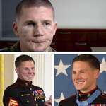image for Medal Of Honor recipient Kyle Carpenter before and after facial reconstruction surgery.
