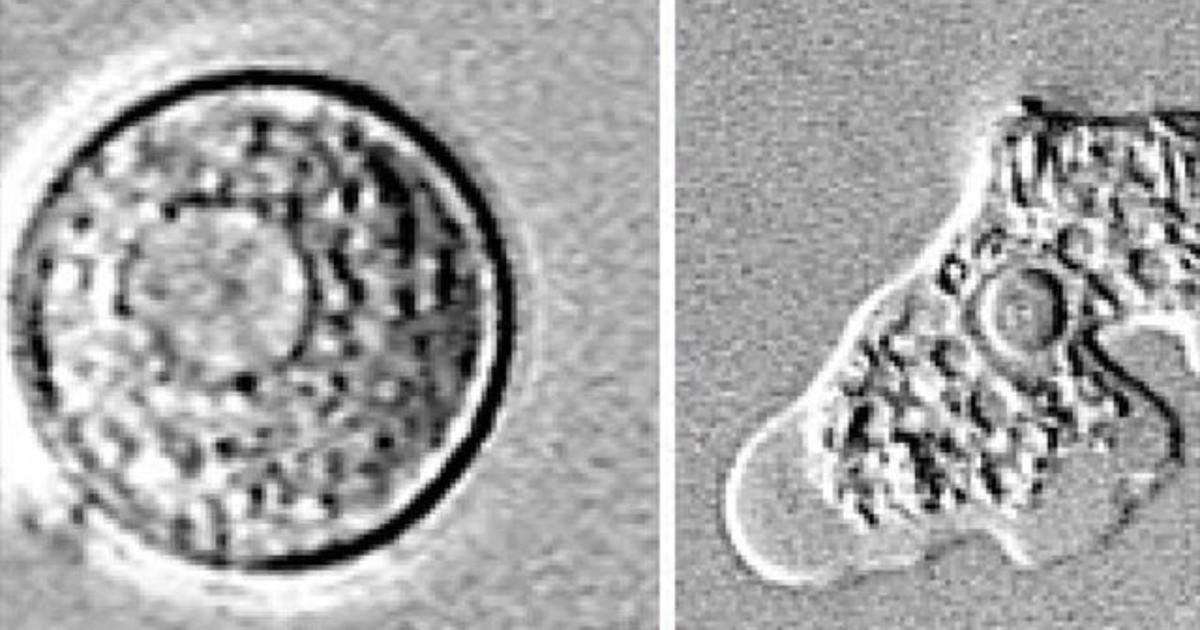 image for 7-year-old dies from rare brain-eating amoeba tied to California lake