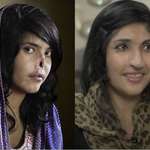 image for Bibi Aisha, disfigured by Taliban husband/in-laws at age 18, before/after reconstructive surgeries