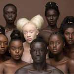 image for An Albino African with her peers.