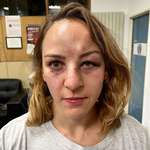 image for Margaux Pinot posted her picture after being attacked by her partner - he was released after a day