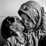 image for Somayeh Mehri & her daughter Rana Afghanipour permanently disfigured in acid attack, by husband.