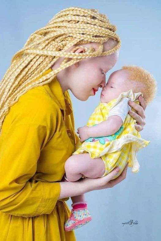 image showing Albino mother and her baby ❤️