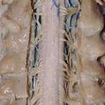 image for This is what the spinal cord looks like.