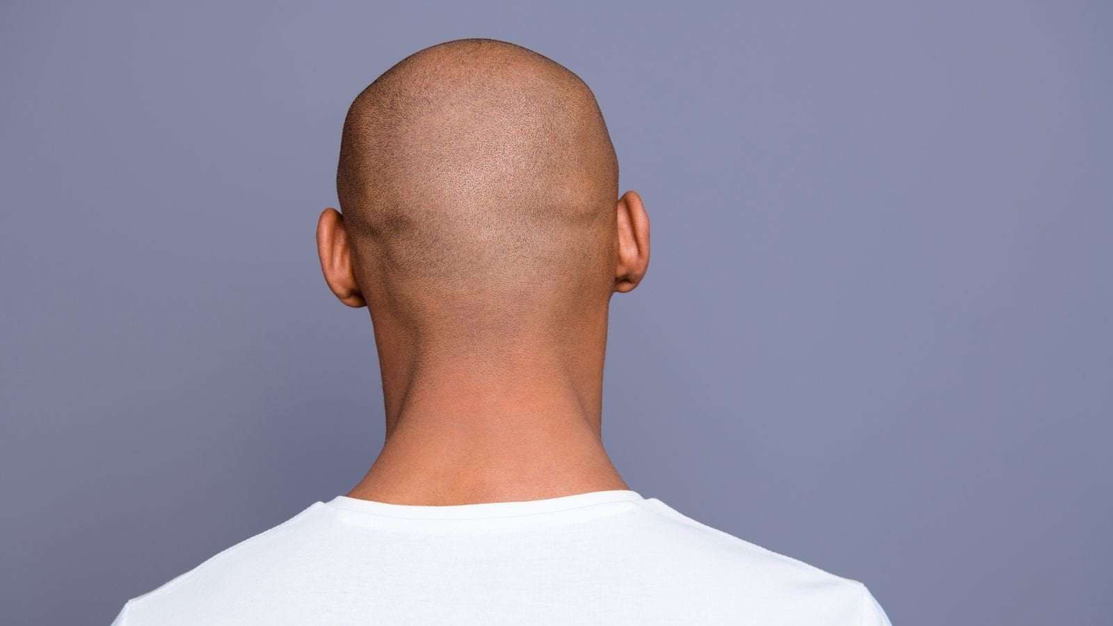 image for Calling a man bald is sexual harassment, employment tribunal rules