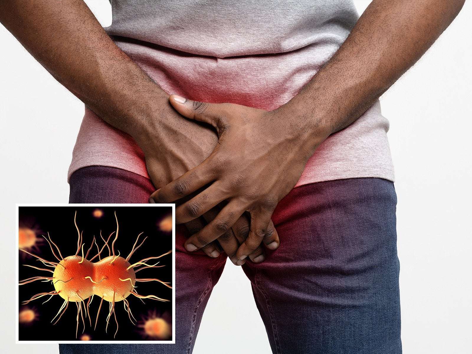 image for Man Gets Extreme, Super-Gonorrhea after Unprotected Sex with Prostitute