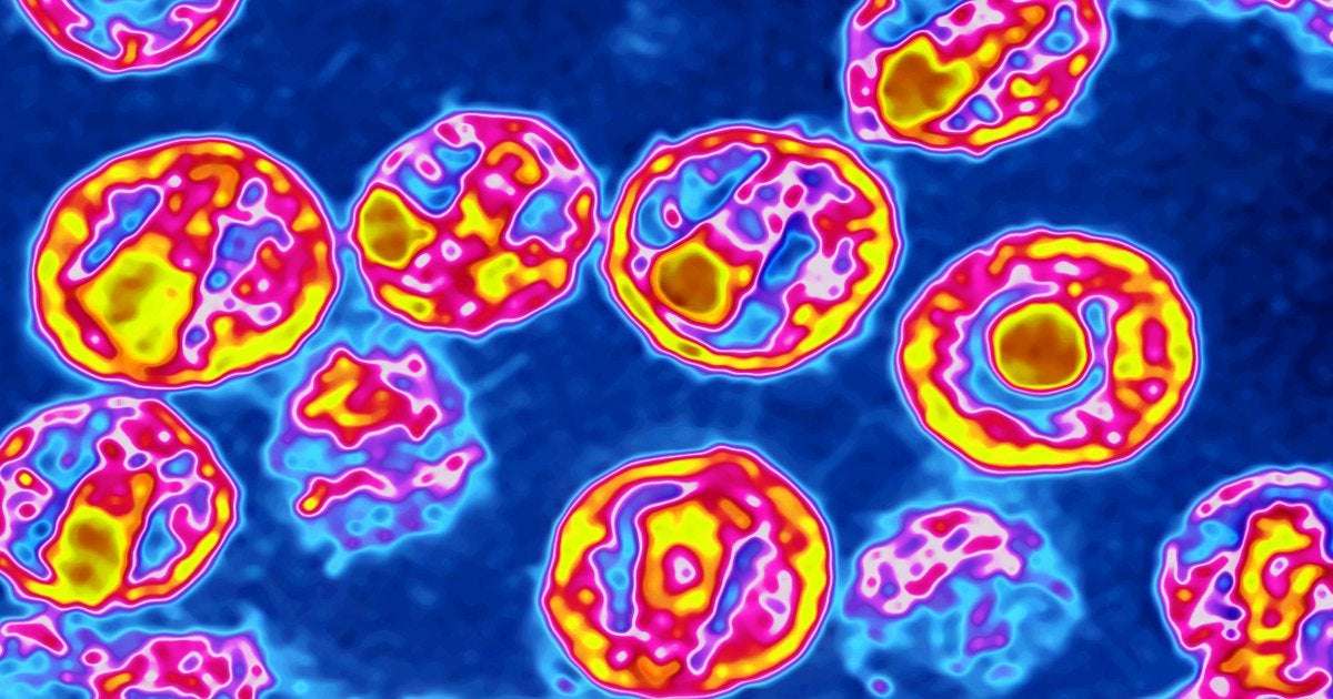 image for A 5th person is likely cured of HIV, and another is in long-term remission