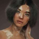 image for ‘Vitiligo’ my latest 3D artwork!