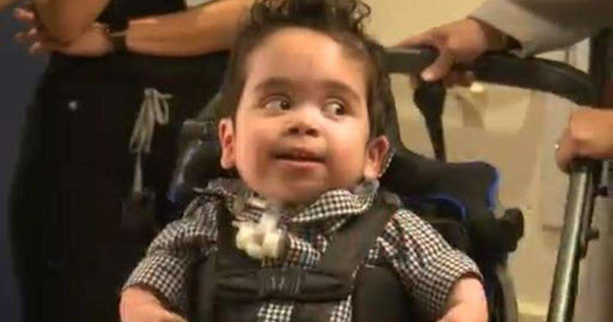 image for "It's really a miracle": Boy who spent first 1,000 days of life in hospitals goes home