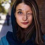 image for Marzieh Ebrahimi, an Iranian survivor of an unprovoked acid attack in 2014 for wearing a "bad hijab"