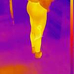 image for My wife's varicose vein shows hotter on my thermal imaging camera (OC)