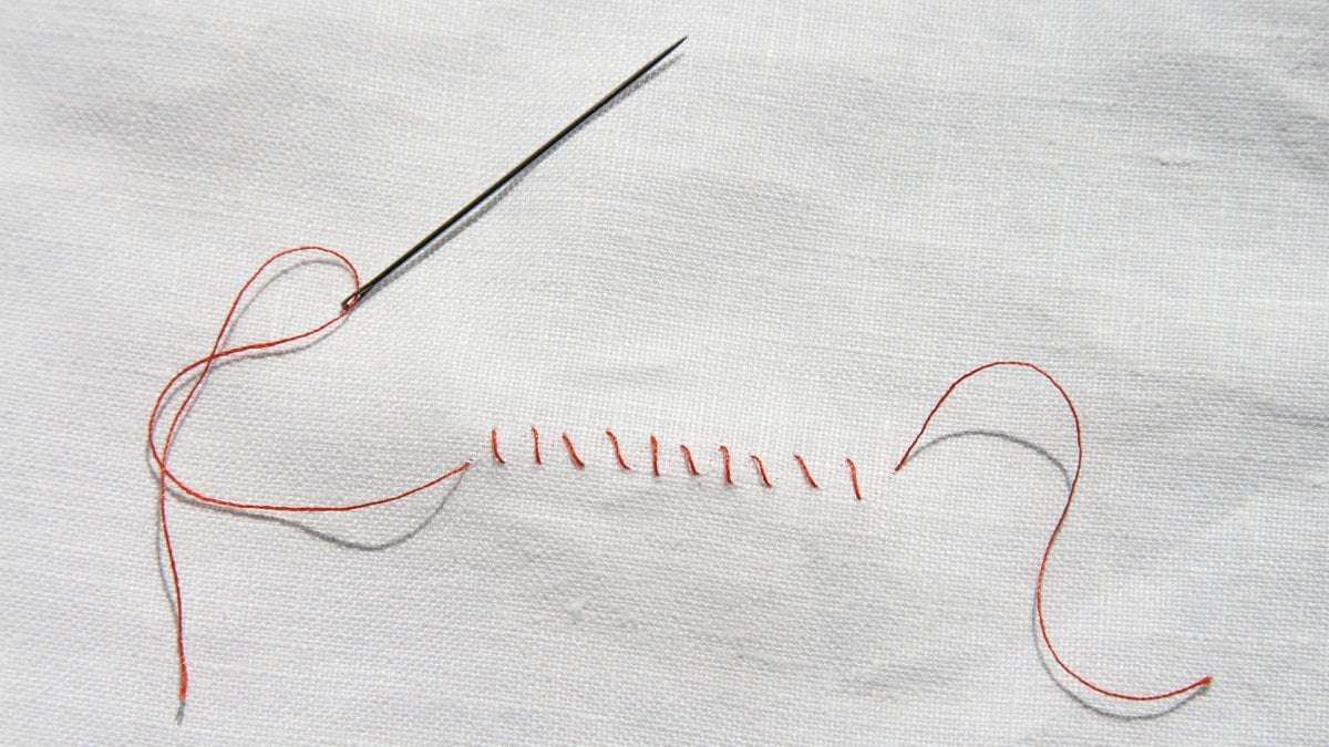 image for Is 'the husband stitch' a medical myth? Women speak out about their experience.