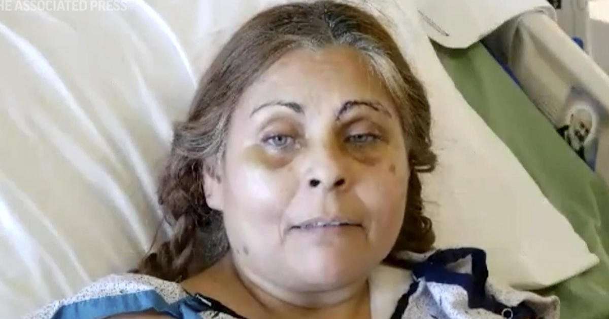 image for Woman who survived Pennsylvania factory explosion said falling into vat of liquid chocolate saved her life