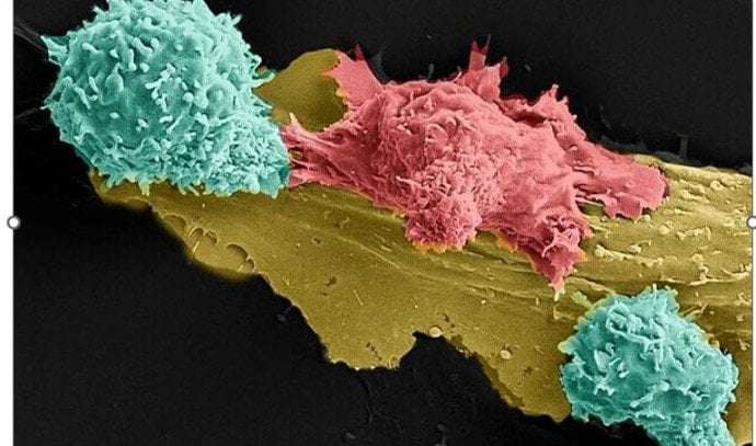image for Groundbreaking Israeli cancer treatment has 90% success rate