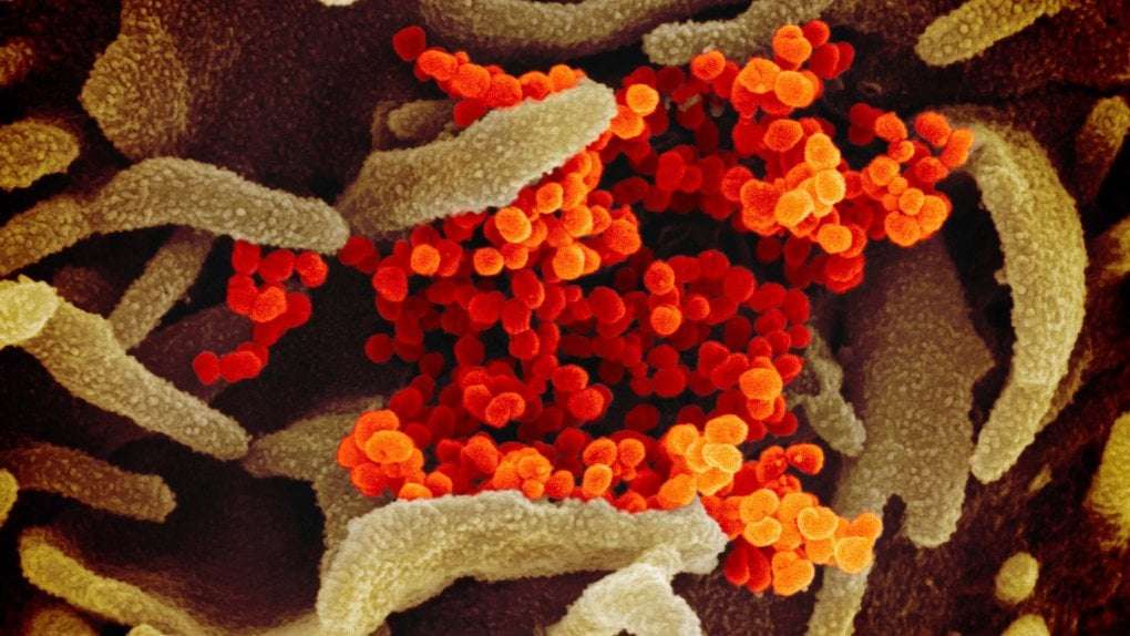 image for Scientists discover antibodies capable of stopping several coronaviruses, potentially preventing future outbreaks