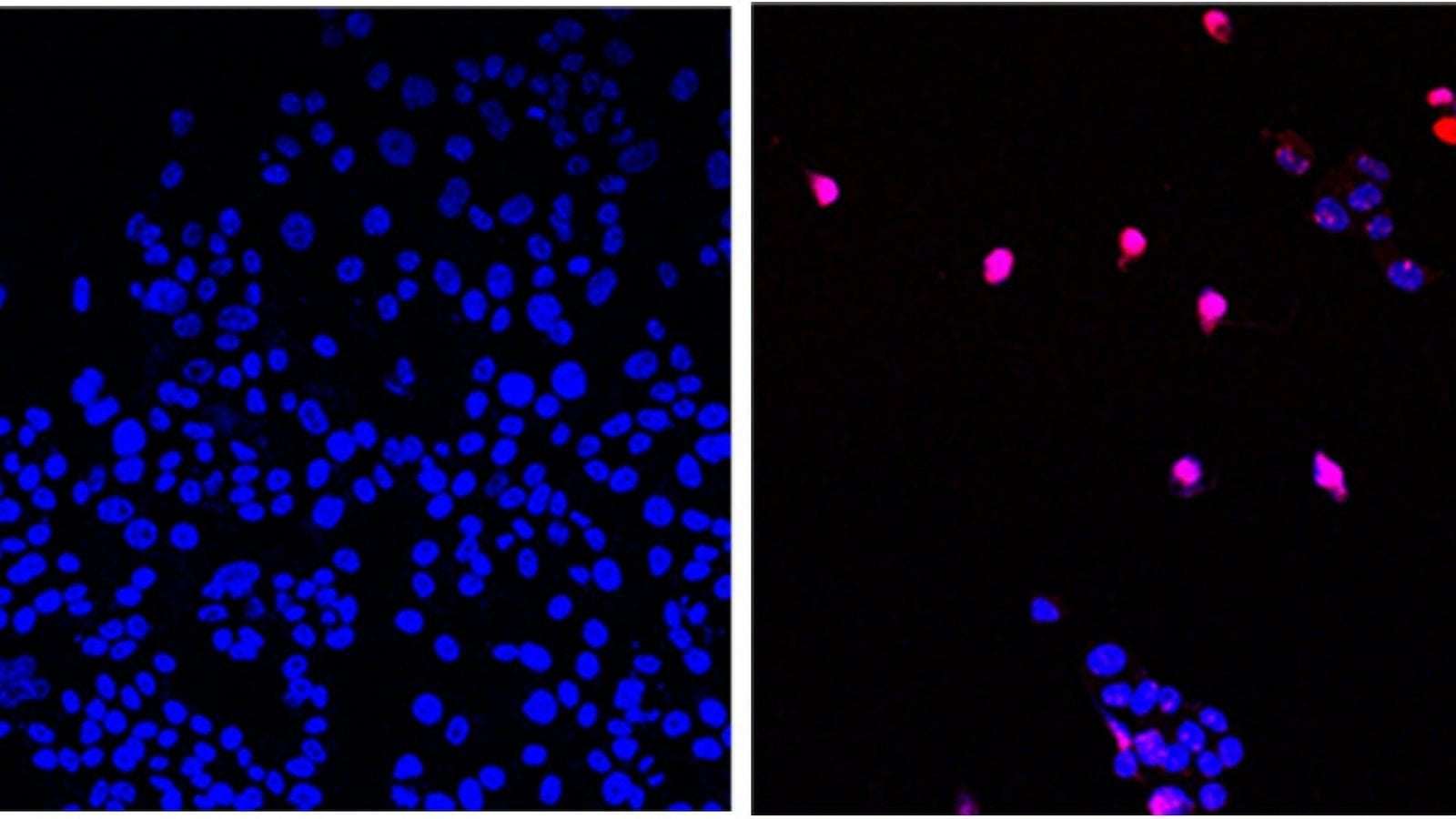 image for 'Cancer-killing pill' that appears to 'annihilate' solid tumours is now being tested on humans