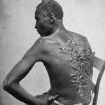 image for “Whipped peter” a slave who escaped during the civil war in 1863, is known for his scars on the back