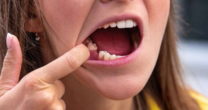image for World’s 1st drug to regrow teeth enters clinical trials - National