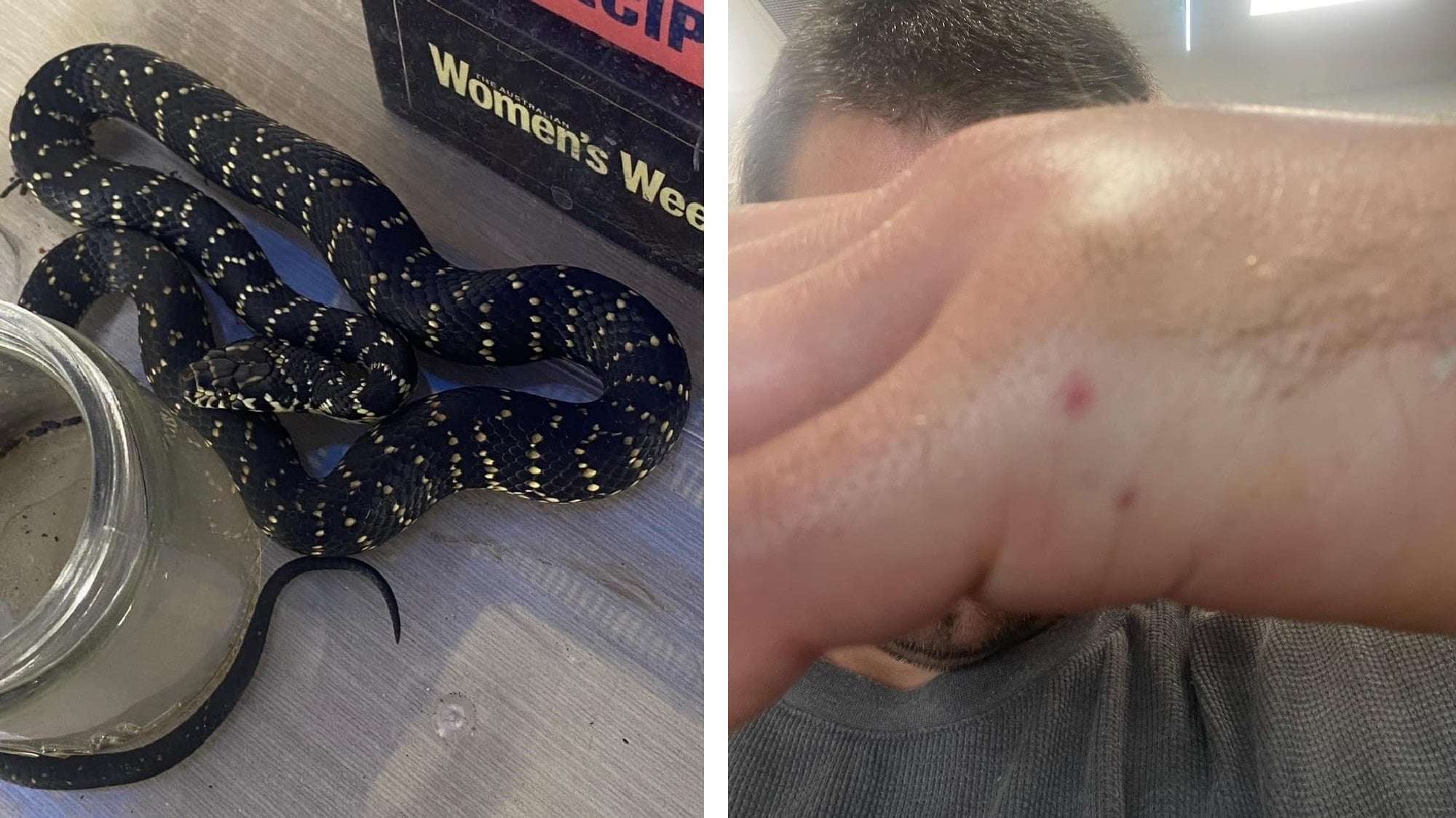 image for Hiker Hospitalized After Bringing Home Venomous Snake to Show His Kids