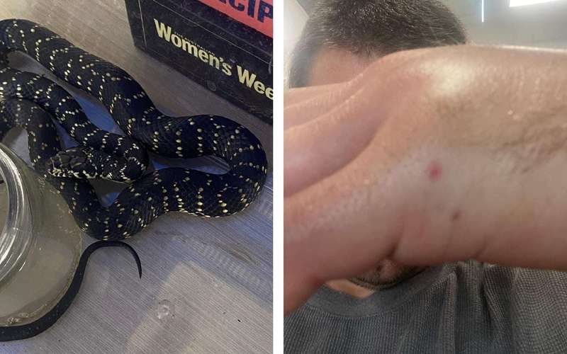 image for Hiker Hospitalized After Bringing Home Venomous Snake to Show His Kids
