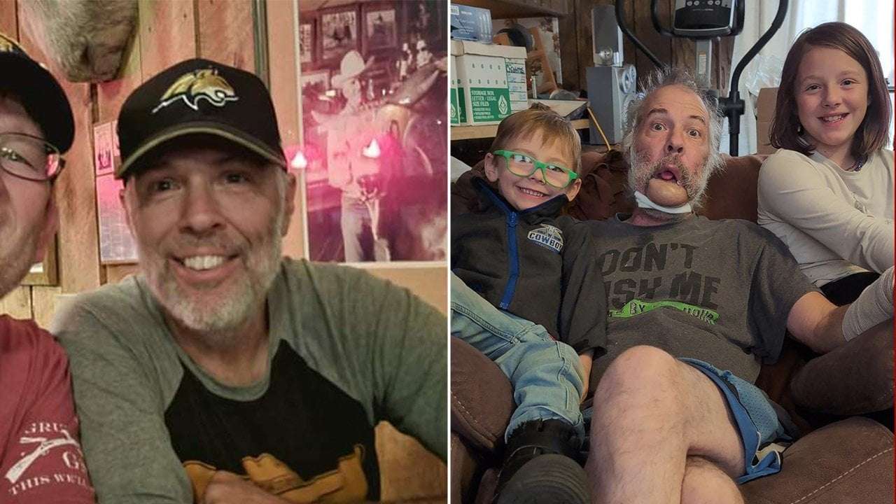 image for Montana grandpa whose jaw was ripped off by grizzly bear attacks recovery: 'he's going to be like Rambo'