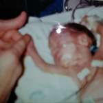 image for I was a 1lb 3oz newborn