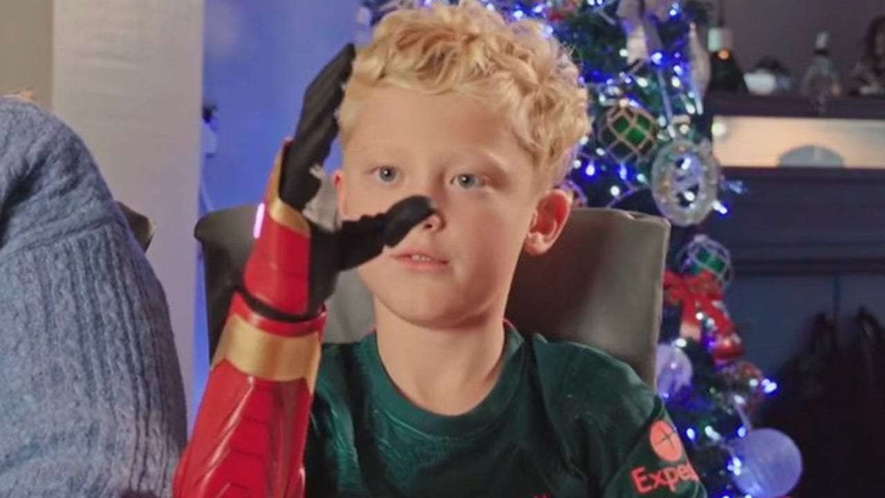 image for 10-year-old boy receives 'Iron Man'-themed bionic arm in early Christmas miracle