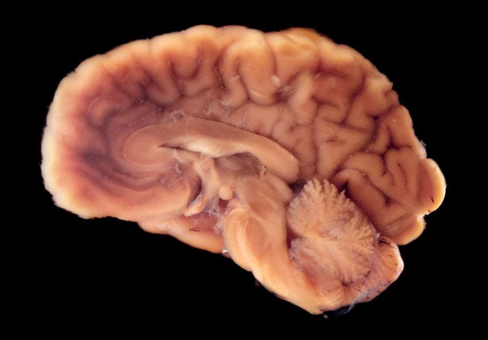 image for Pig Brain Kept Alive for Five Hours While Separated from the Body