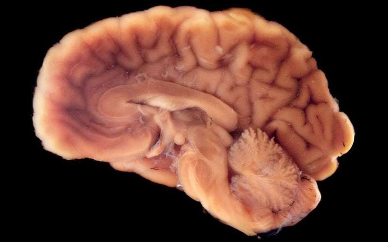 image for Pig Brain Kept Alive for Five Hours While Separated from the Body
