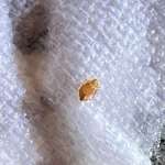 image for Found a live bed bug crawling inside a new sealed packet containing the dress we ordered (see link)