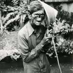 image for Image from 1984 shows an Indonesian man suffering from leprosy.