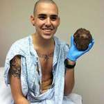 image for A man holds his old diseased heart after a heart transplant.