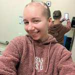 image for I may be patchy headed but I still feel beautiful! Alopecia will never take away my smile!