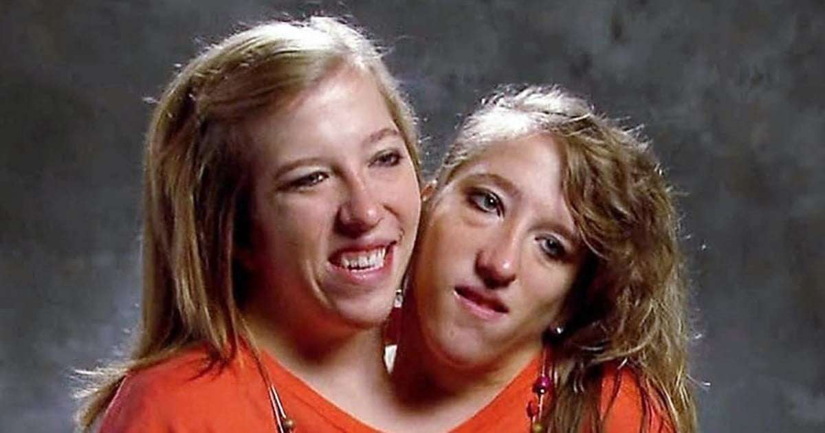 image for Conjoined twin Abby Hensel is now married