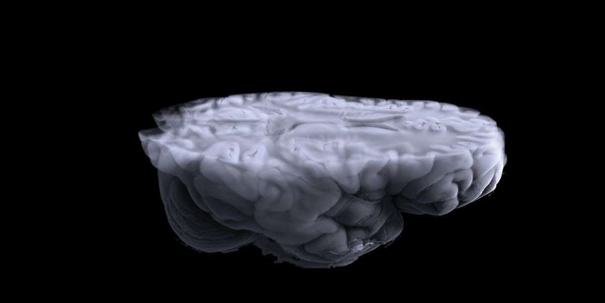 image for Human Brains Have Gotten Astonishingly Bigger Over the Last 75 Years