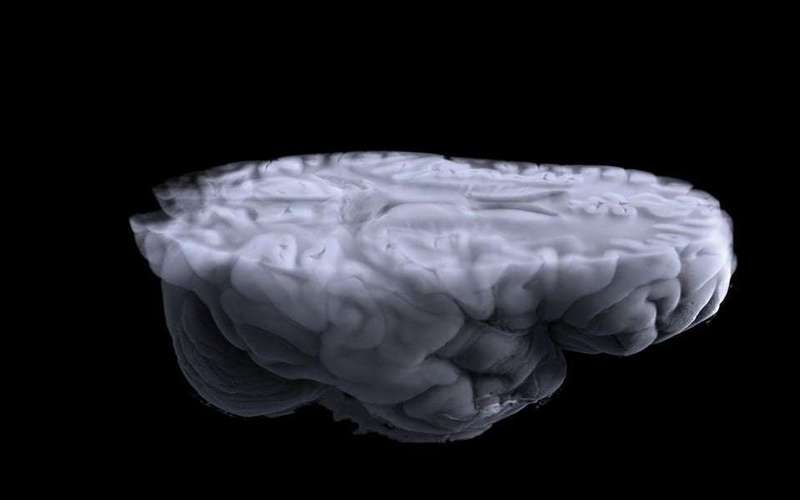 image for Human Brains Have Gotten Astonishingly Bigger Over the Last 75 Years